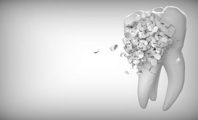 Teeth, orthodontist
