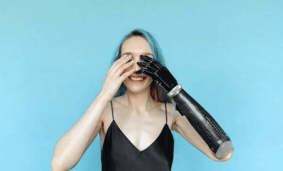 Woman with a prosthetic arm